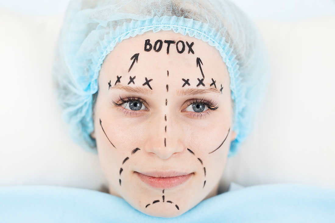 botox yüz hatları