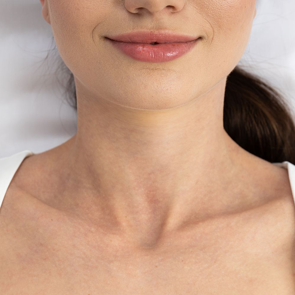 Boyun & Dekolte Botoksu