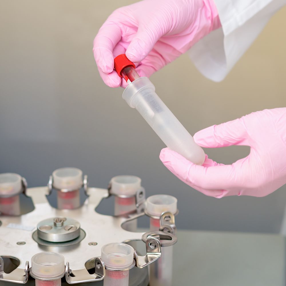 Cellphi Autologous (Otolog Hücre) Uygulamaları