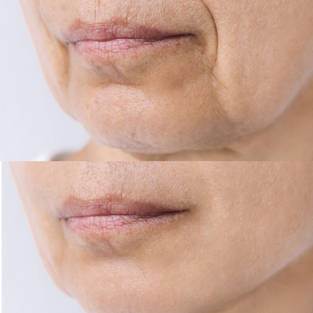 Karisma Uygulamaları