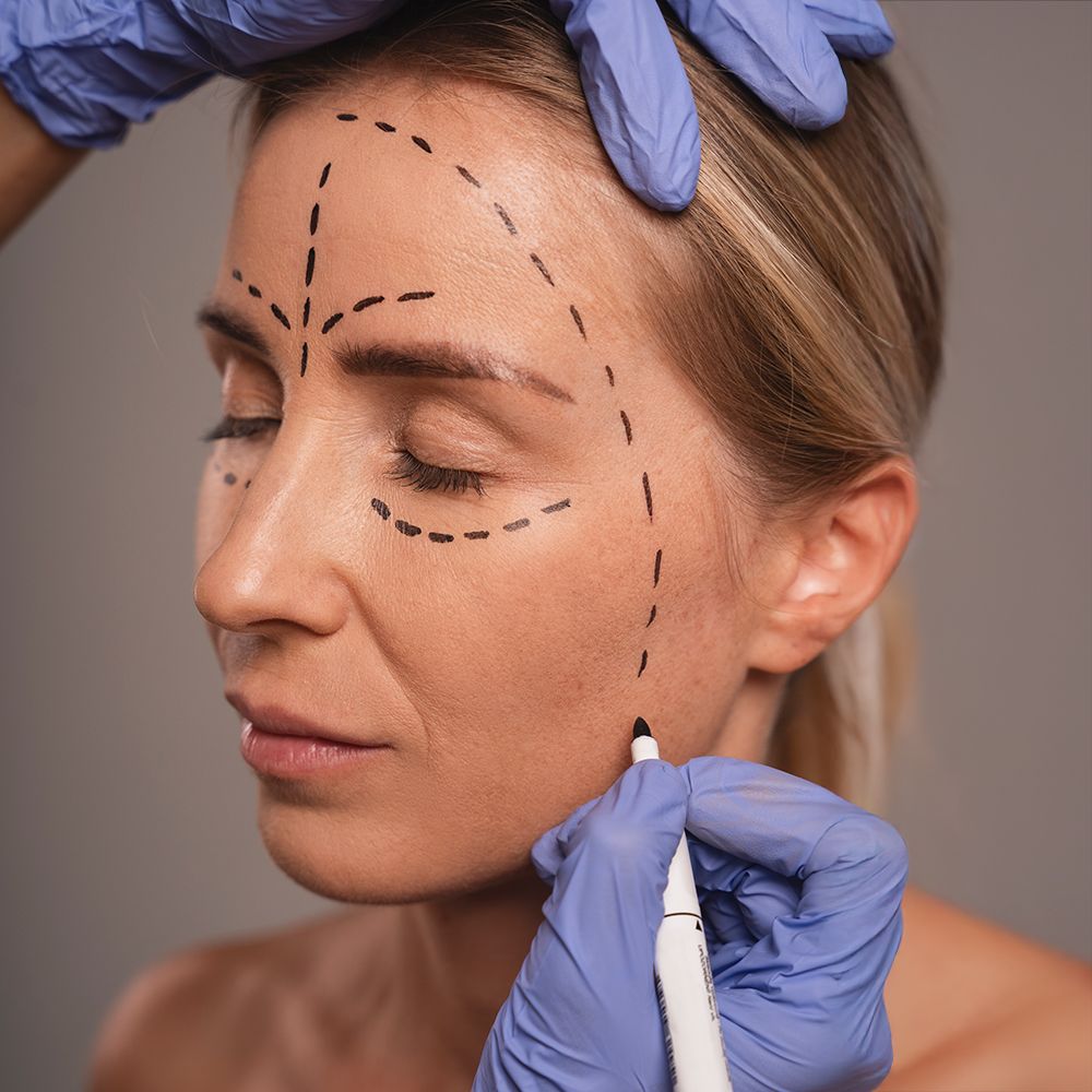 Şakak & Kaş Kaldırma Dolgusu