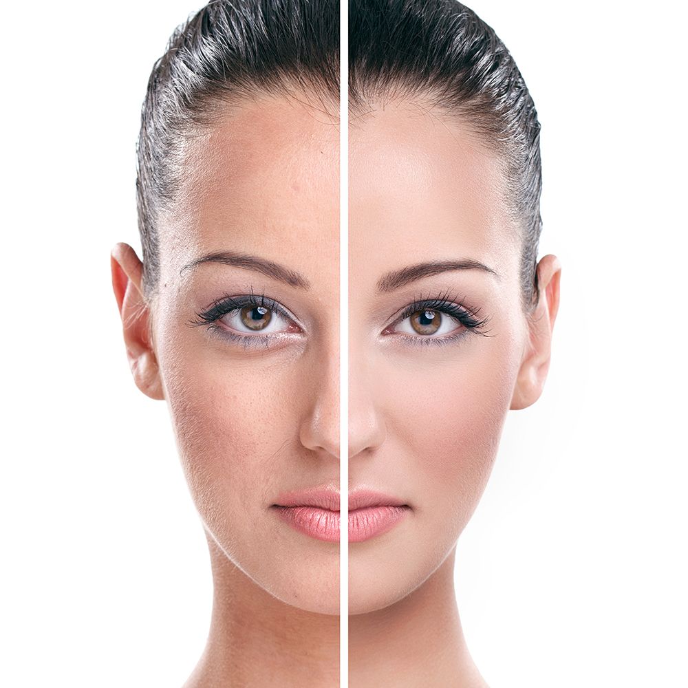 Skinvive Uygulamaları